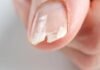 হাতের নখ ভেঙে গেলে কী করবেন, সহজ যত্নেই মিলবে সমাধান