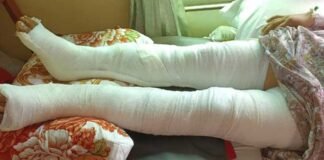 শিবপুরে শিক্ষকের পায়ের রগ কেটে দেওয়ার অভিযোগ, ভাঙচুর-অগ্নিসংযোগ